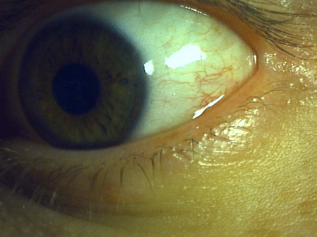 Eye see you!
